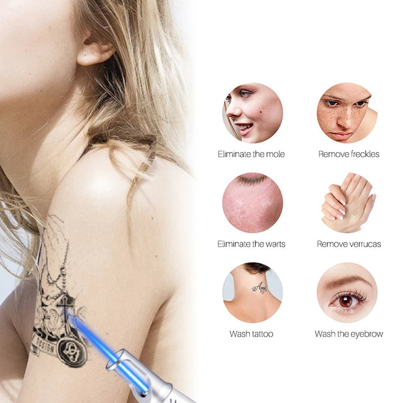 AstraGlow Home Laser Pen For Tattoo, Mole And Freckle Removal