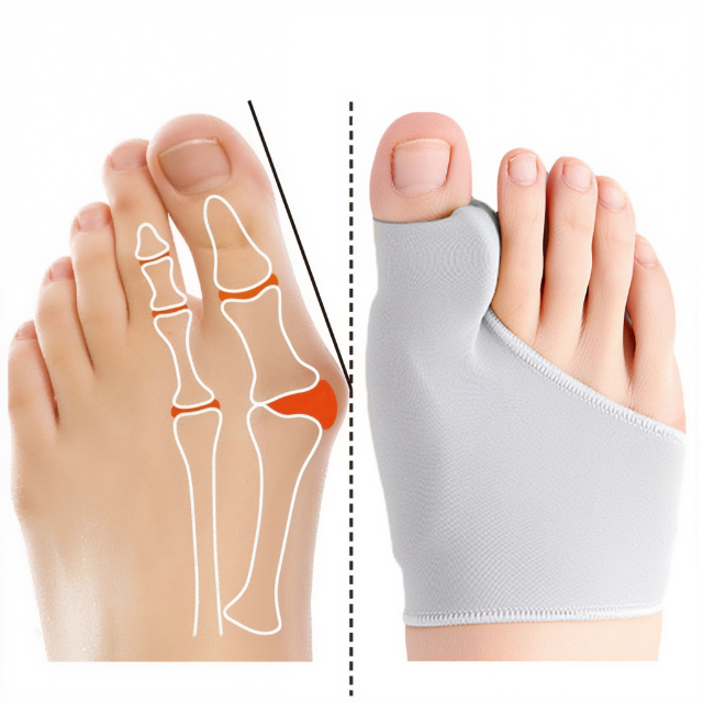 Charly | Bunion Corrector with Gel Pad Support