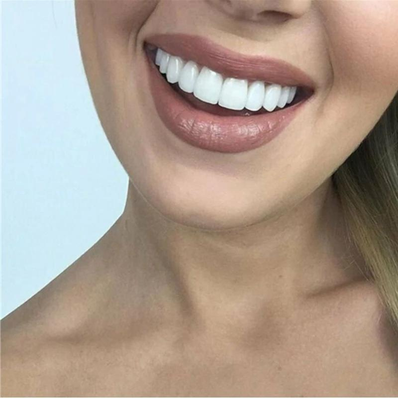 Charly | Cosmetic Dentures for a Natural Smile