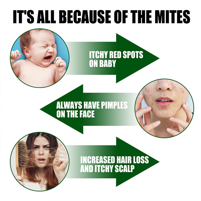 Charly | Powerful Mite Remover Spray