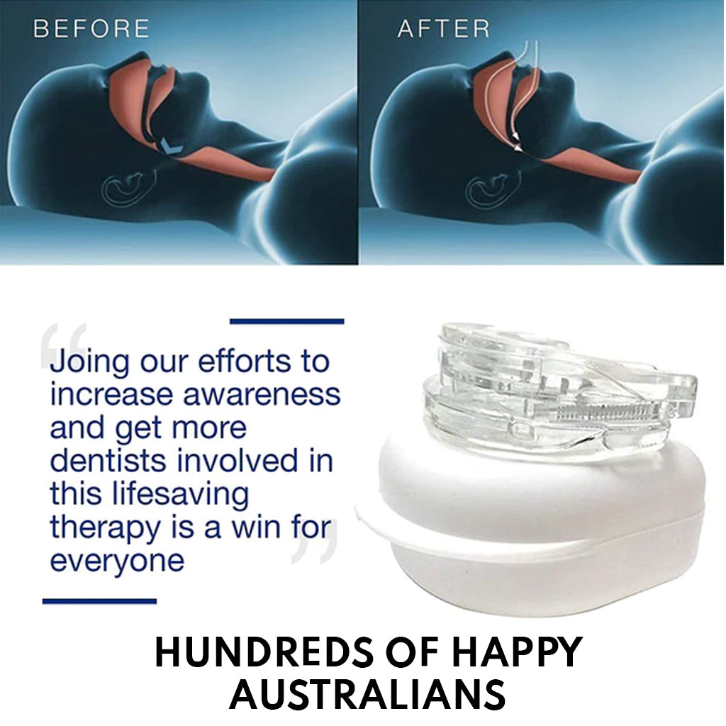 SilentForm Anti-Snoring Device – Adjustable, Optimized Comfort, Effective Solution for Sleep